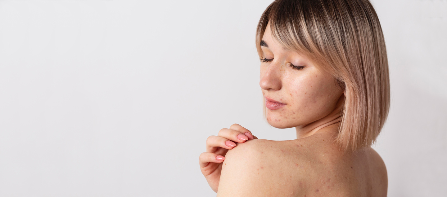 Дерматологія Києва - Консультація дерматолога | МЦ Лелека