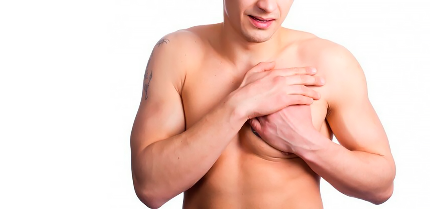 Гінекомастія: симптоми, ознаки та лікування гінекомастії у чоловіків у Києві | МЦ Лелека Гінекомастія: симптоми, ознаки та лікування гінекомастії у чоловіків у Києві | МЦ Лелека