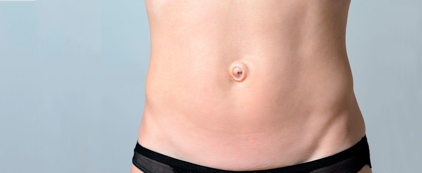 Лікування пупкової грижі у дорослих у Києві | МЦ Лелека