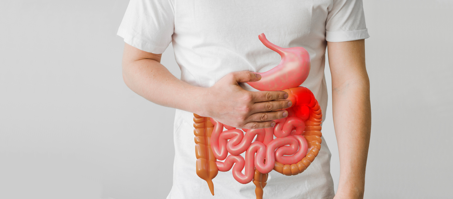 ᐈ Лечение болезни Крона в Киеве ~ МЦ Лелека