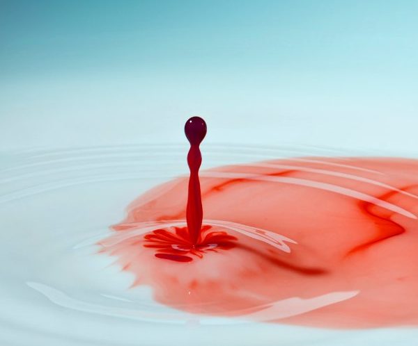 Ендоваскулярна хірургія в гінекології, інноваційні методи в Києві | МЦ Лелека