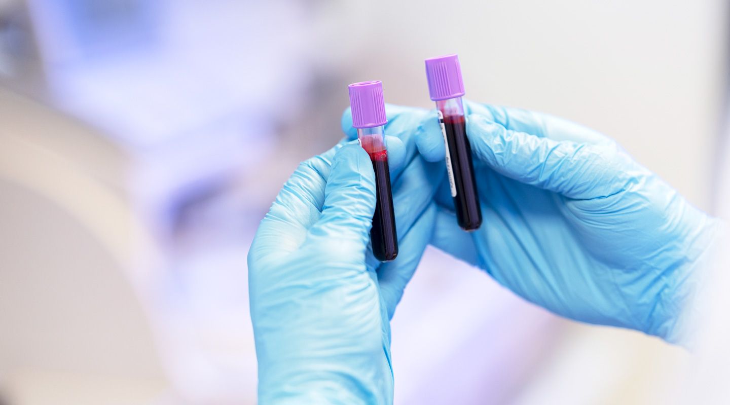 ≡ Онкогематология в Киеве при разных видах рака крови | МЦ Лелека