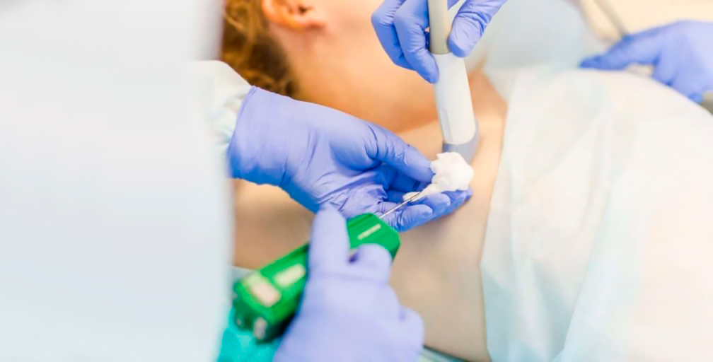 Трепан біопсія грудей в Києві ✔️ Ціни на трепан біопсію | МЦ Лелека Трепан біопсія грудей в Києві ✔️ Ціни на трепан біопсію | МЦ Лелека