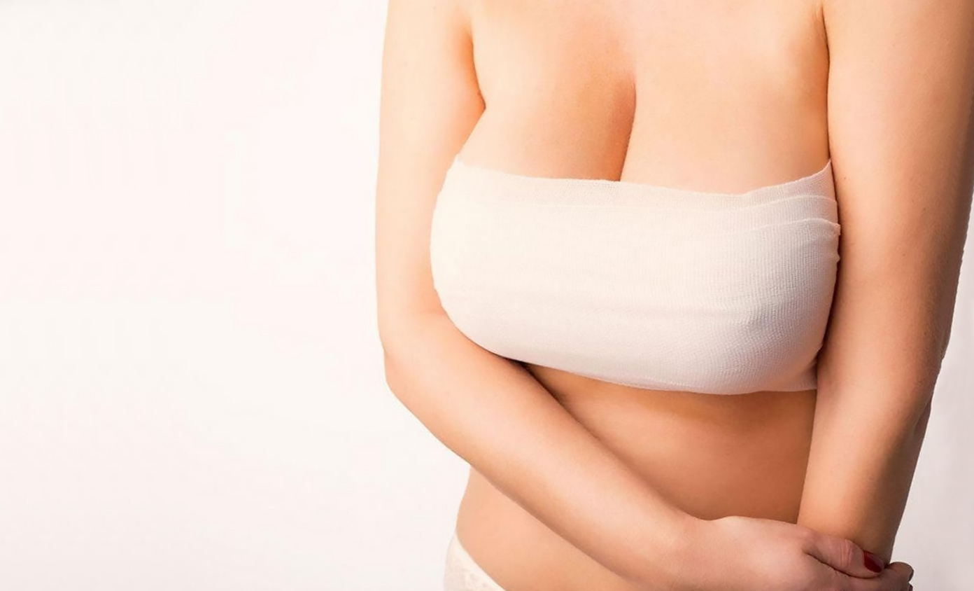 Редукційна мамопластика, зменшення грудей в Києві | МЦ Лелека Редукційна мамопластика, зменшення грудей в Києві | МЦ Лелека