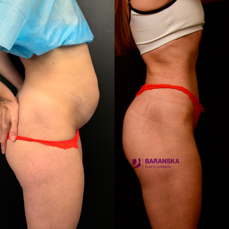 Пластична хірургія в Києві | МЦ «Лелека»