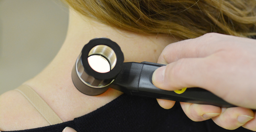 Check-up «Перевір родимки» зі знижкою | Новини | Медіацентр