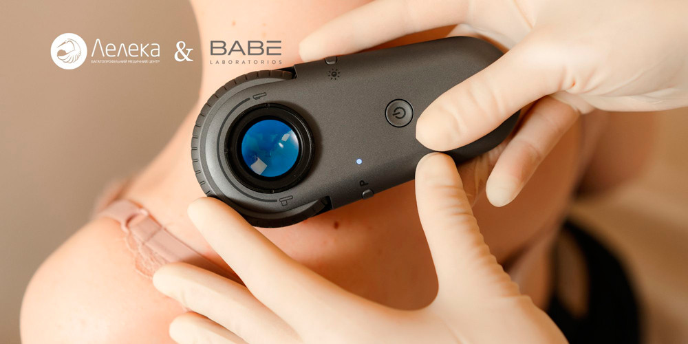 Дні безкоштовної діагностики родимок у «Лелеці» | Новини | Медіацентр